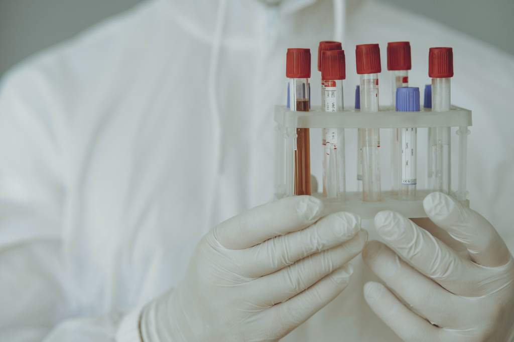 vials of blood after getting lab work drawn